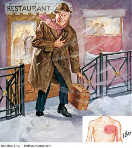 Heart attacks are more frequent in colder weather: Frank Netter’s famous painting